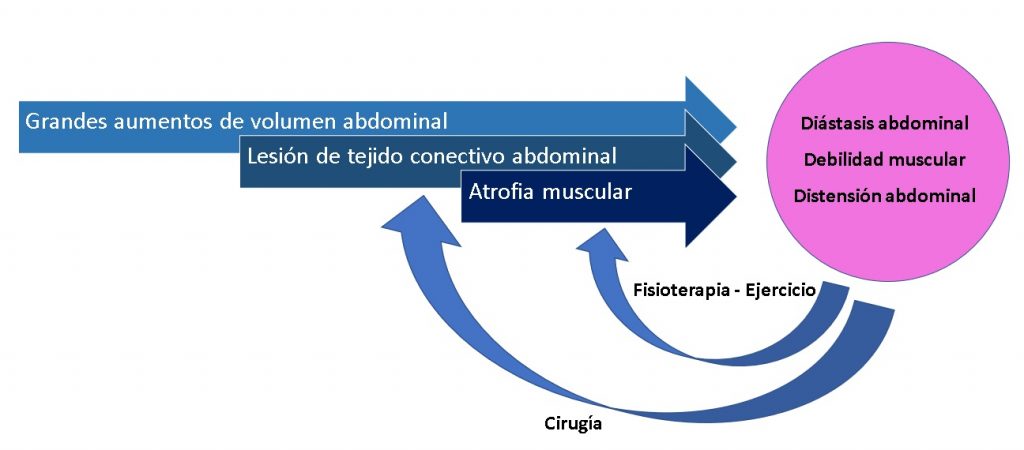 cirugía minimamente de la diástasis