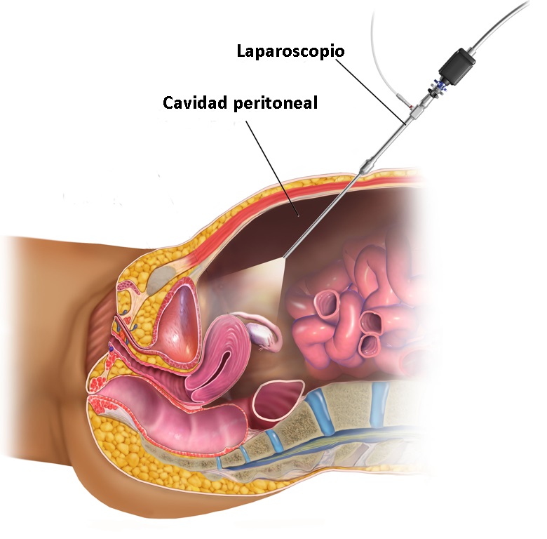 cirugía mini-invasiva imagen 8